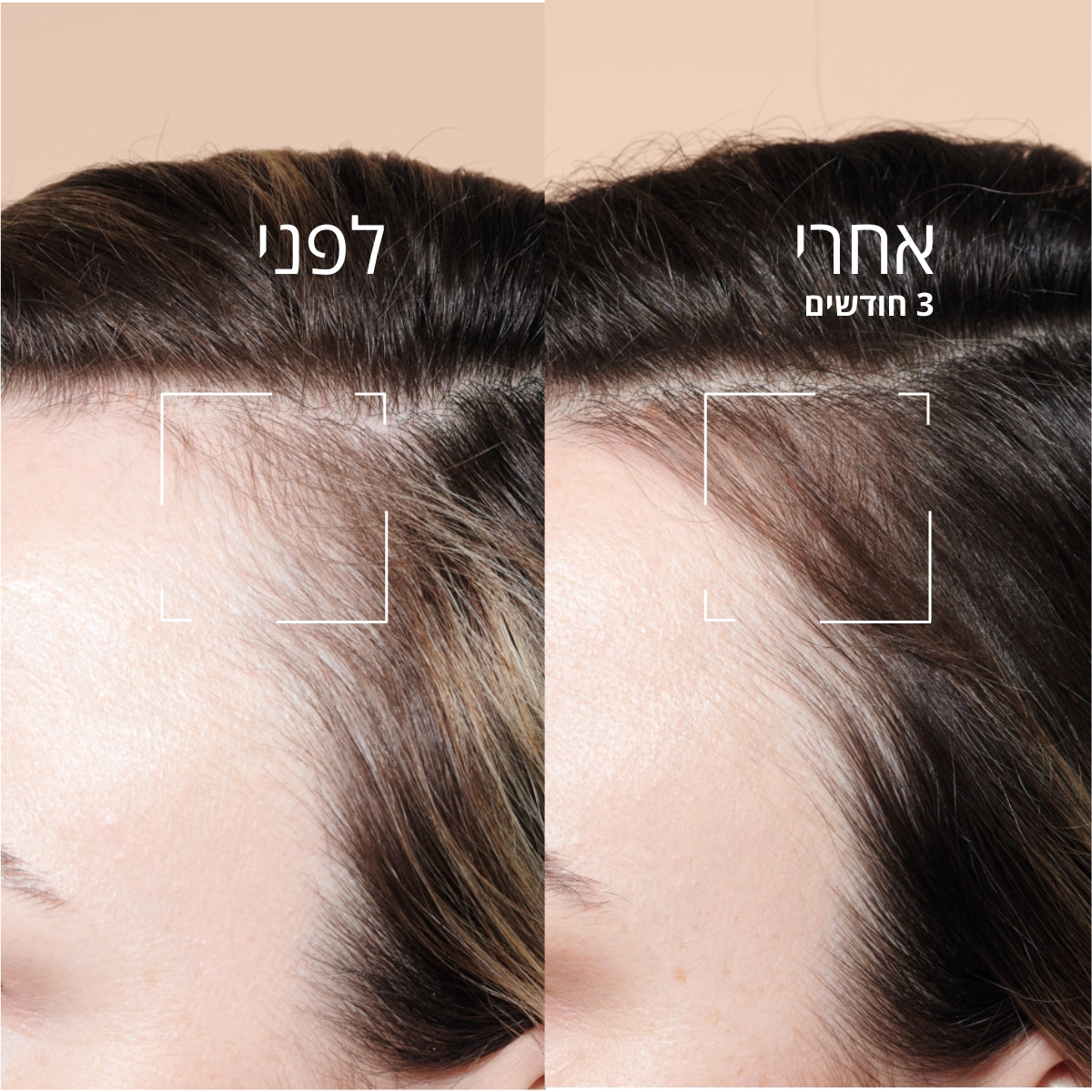 מוצרי טיפוח שיער ל'אוקסיטן – חיזוק והזנה